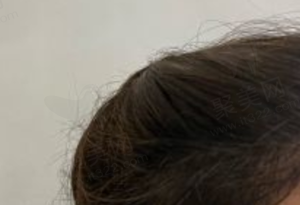 深圳倍生医疗美容门诊部怎么样