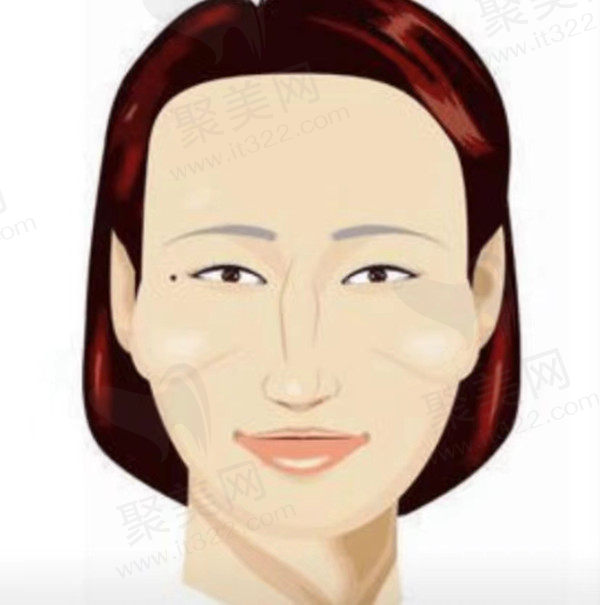 不用手术的方法自然改善颧弓外扩