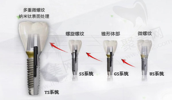 韩国奥齿泰种植牙