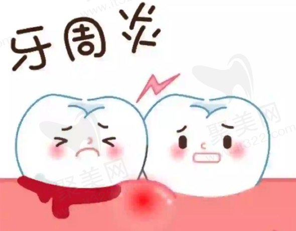 患有牙周炎怎么办？该怎么治疗？
