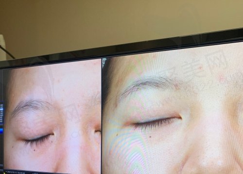 南京金鹰医疗美容怎样