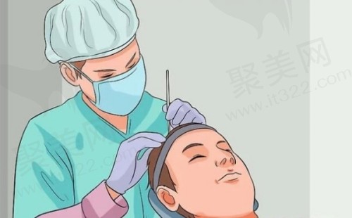 国内植发医院排名前十