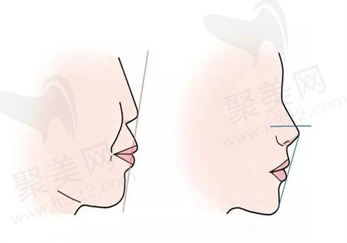 何锦泉预约挂号方式