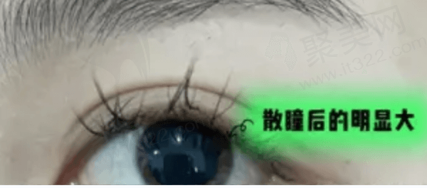 沈阳爱尔卓越眼科医院怎么样？