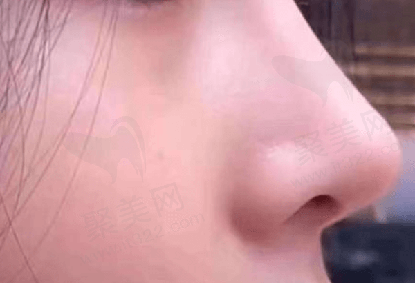 金水梨花雨医疗美容门诊部做鼻子怎么样
