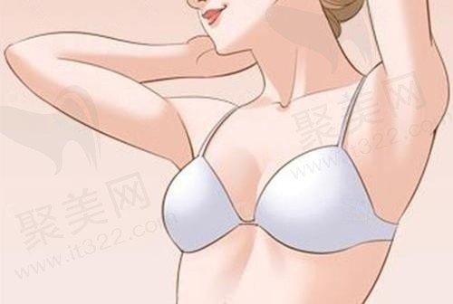 杭州美莱栗勇缩胸术后反馈