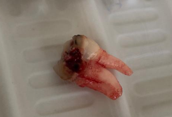 衢州新荷可恩口腔正规吗