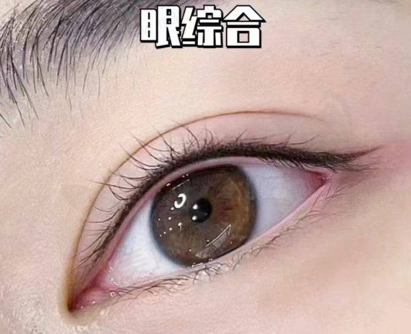 眼综合的优势在哪