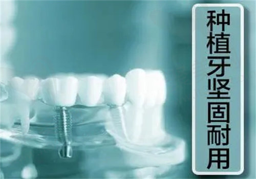 衢州可恩口腔种植牙技术先进