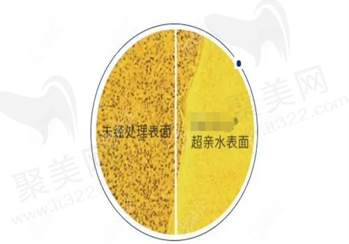衢州可恩口腔种植牙好在医生经验丰厚