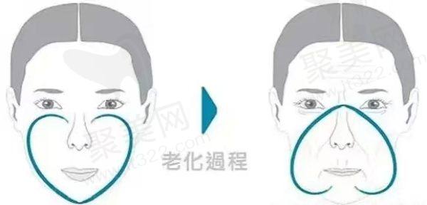 导致苹果肌下垂的原因？