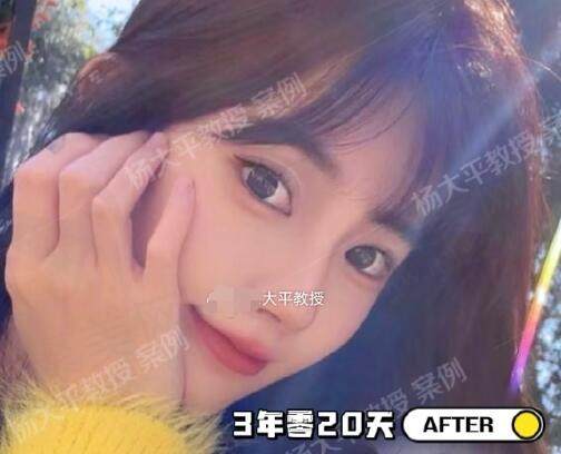 杨大平医生做拉皮怎么样