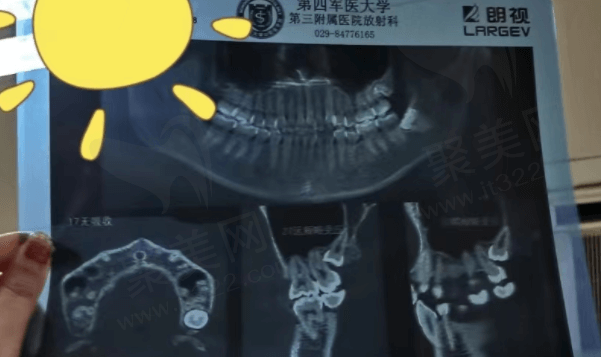 第四军 医大学口腔医院