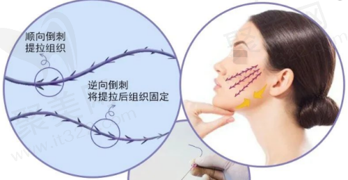 北京隋冰医生馒化脸修复口碑评价
