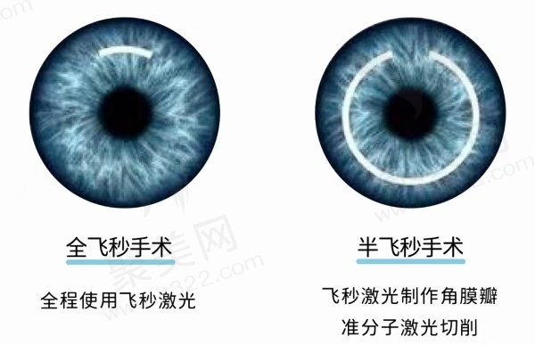 青岛华夏眼科收费价格表