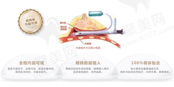 上海美莱唐毅隆胸修复