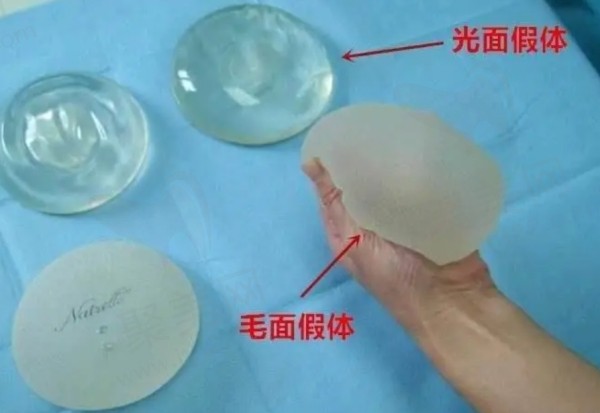 曼托假体