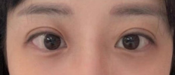@奶茶要放7分糖的双眼皮评价