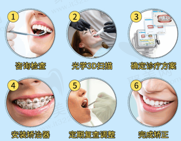 常州北极星口腔医院金属矫正价格