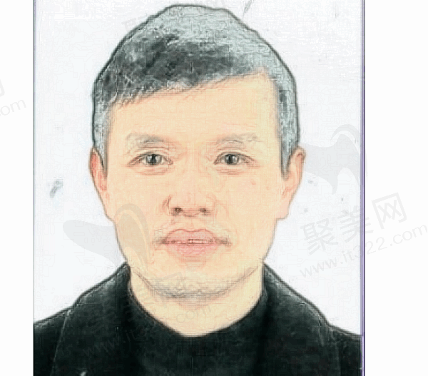 宁波市杭州湾医院眼科周奇鸣医生