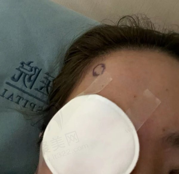 半飞秒手术