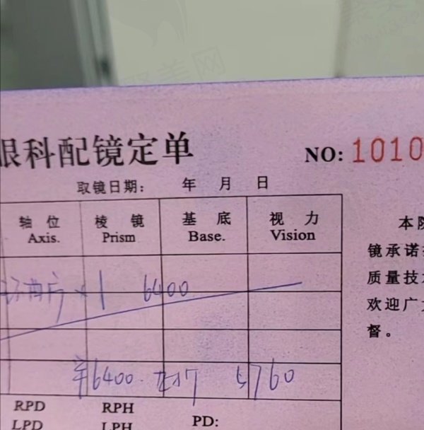 配镜评价
