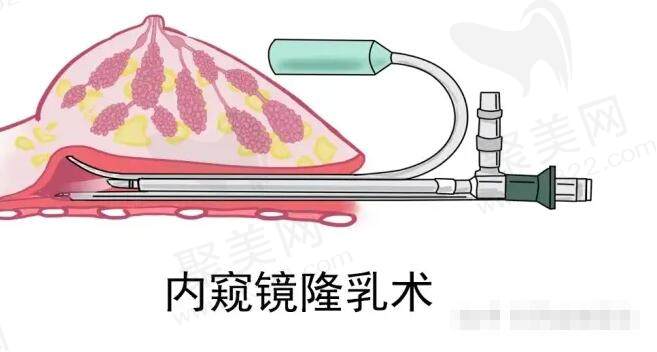 深圳艺星整形医院是正规的吗