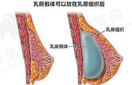 深圳艺星整形整形价格表