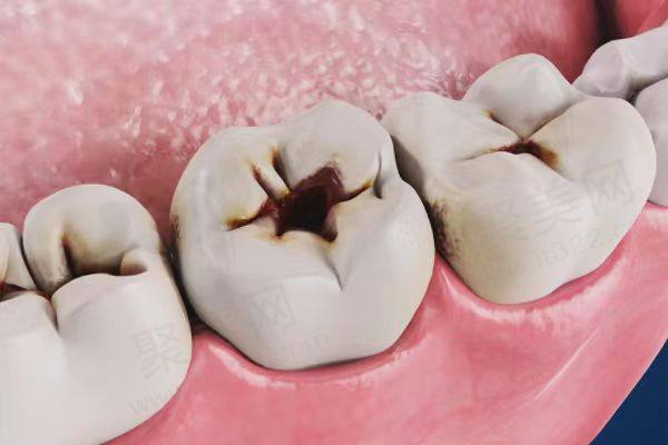 徐州美奥口腔其他牙科项目价格