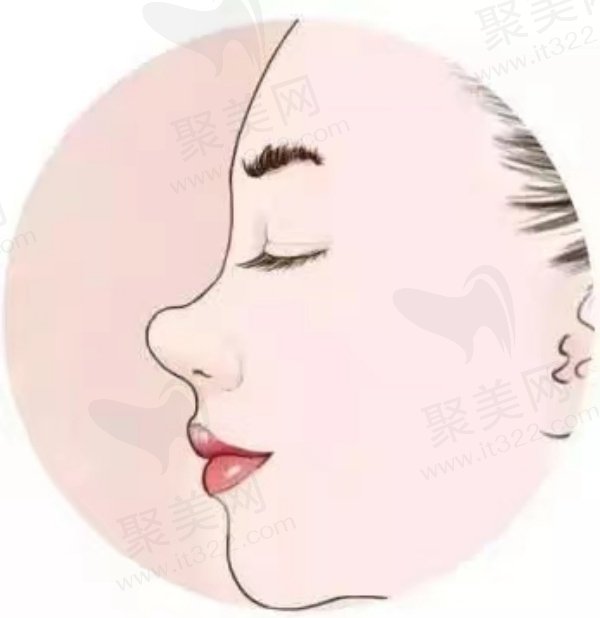 成都西区段焘特色鼻整形技术介绍