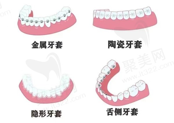 北京禾禾口腔牙齿矫正价格表