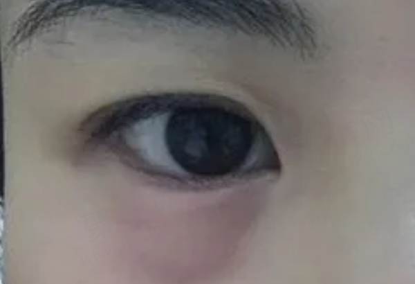 南通大学附属医院眼科怎么样