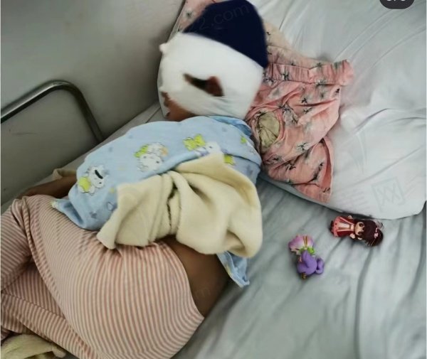 近视手术评价