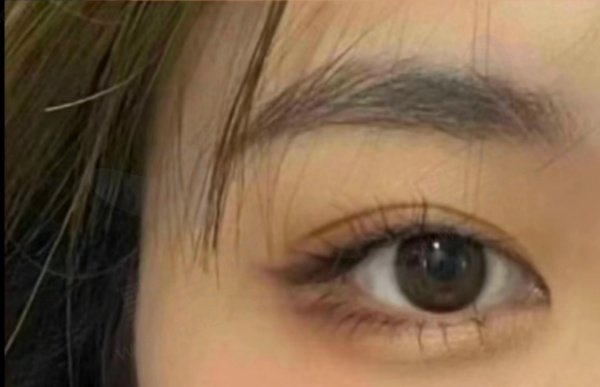 网友双眼皮评价1