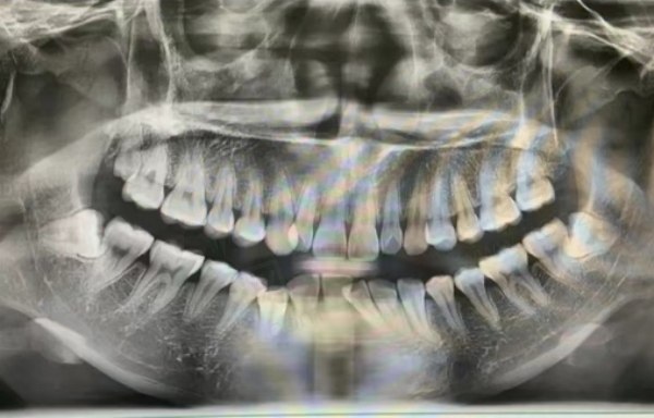 重庆江津益尔泽志口腔口碑