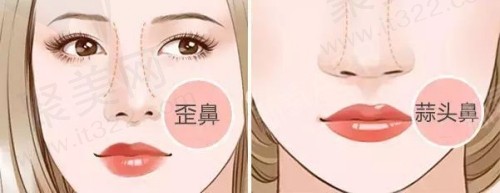 国内鼻修复医生专 家排名