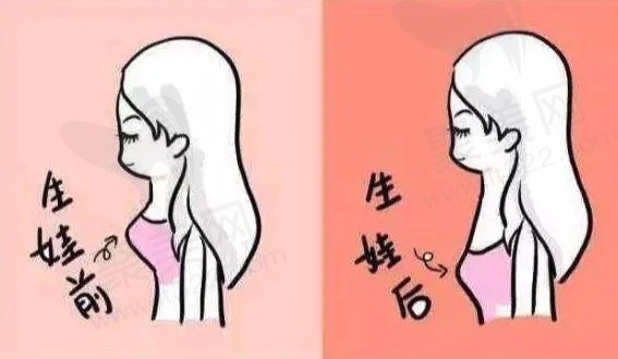 产后胸下垂有什么办法能挺起来
