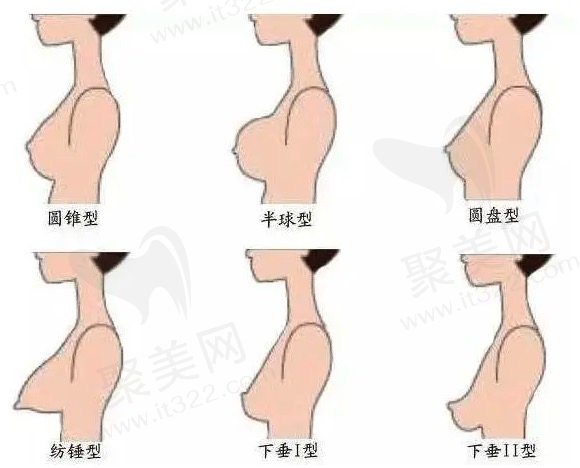 生完孩子后胸为什么会下垂呢？