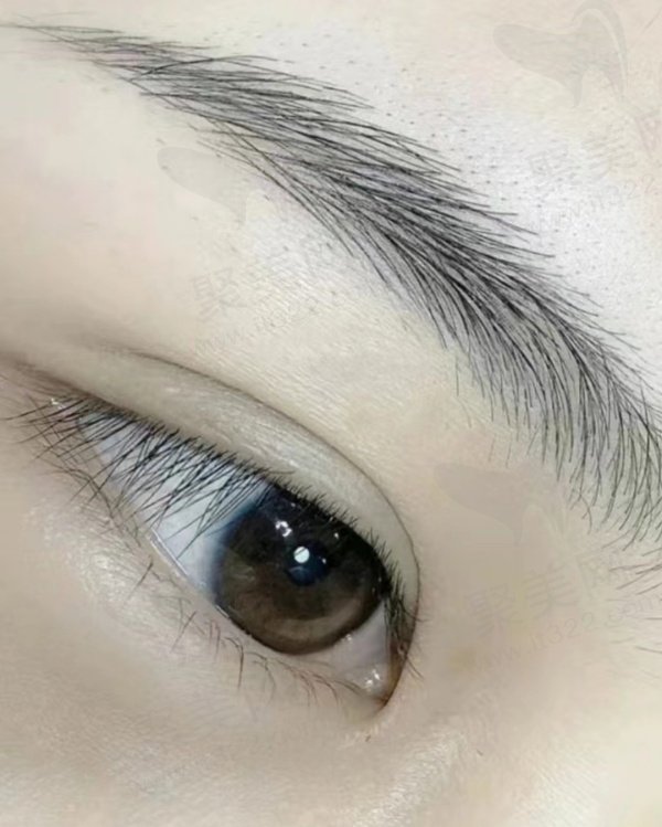 双眼皮评价1