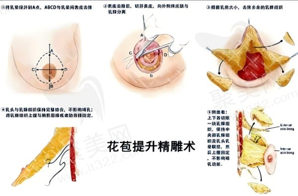 花苞提升<span style=