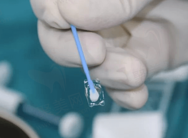 南京东南眼科医院赵丹丹医生近视手术做的怎么样？