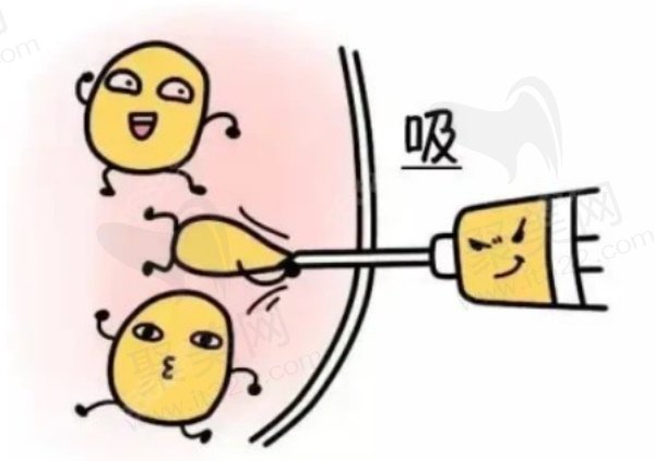 潘红伟吸脂技术好