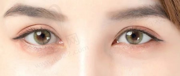 上海薇琳医疗美容医院眼部整形医生推荐