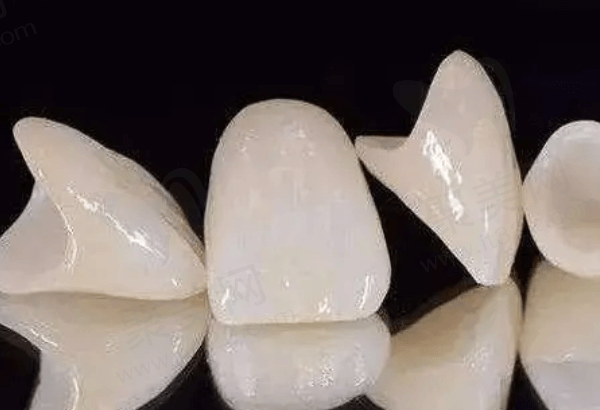 烤瓷牙和全瓷牙哪个使用时间更长