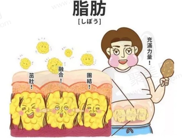 成都画美吸脂收费贵吗