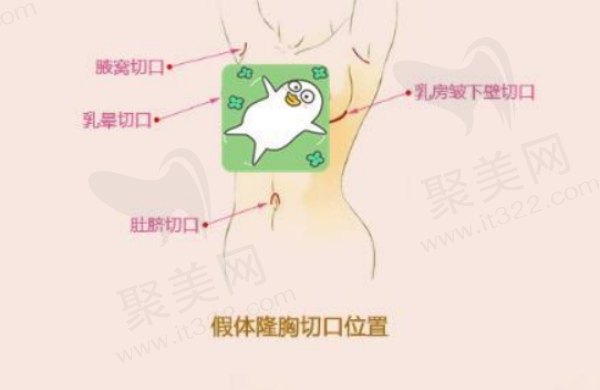 文婷医生于2023荣获傲诺拉<span style=