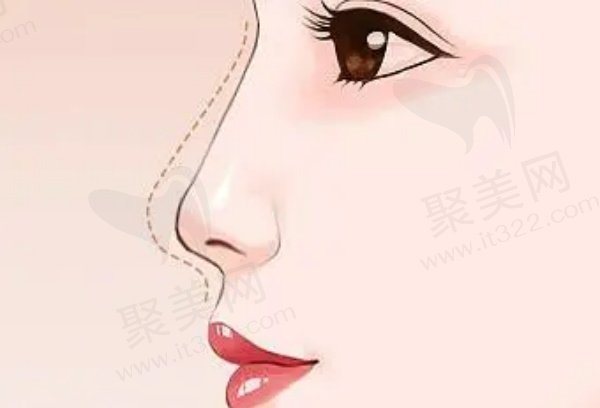 深圳非凡梅够明做鼻子好吗