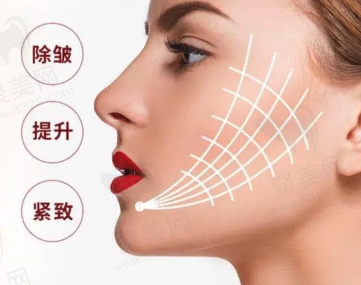 热拉提做完皮肤更松了是怎么回事？