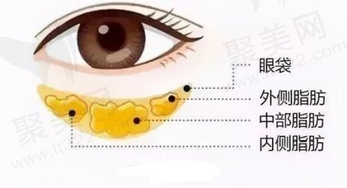 青岛波罗蜜整形医院去眼袋价格