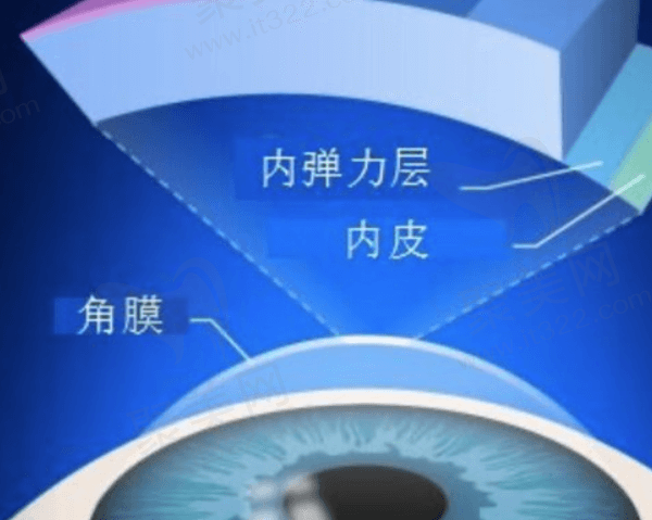 佛山爱尔眼科医院蔡司全飞秒手术多少钱？
